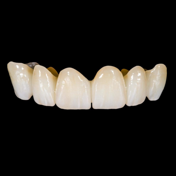 Corona zirconia-ceramica